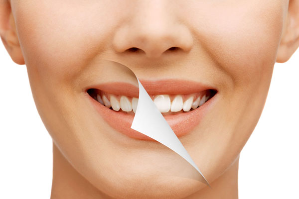 Bleaching Vorher-Nachher · Gemeinschaftspraxis für Zahn-, Mund- und Kieferheilkunde Dr. Gorden & Dr Poll