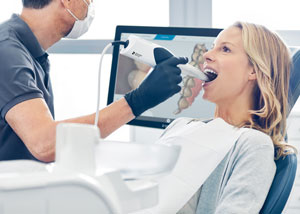 Primescan · Scanner statt Abdruck