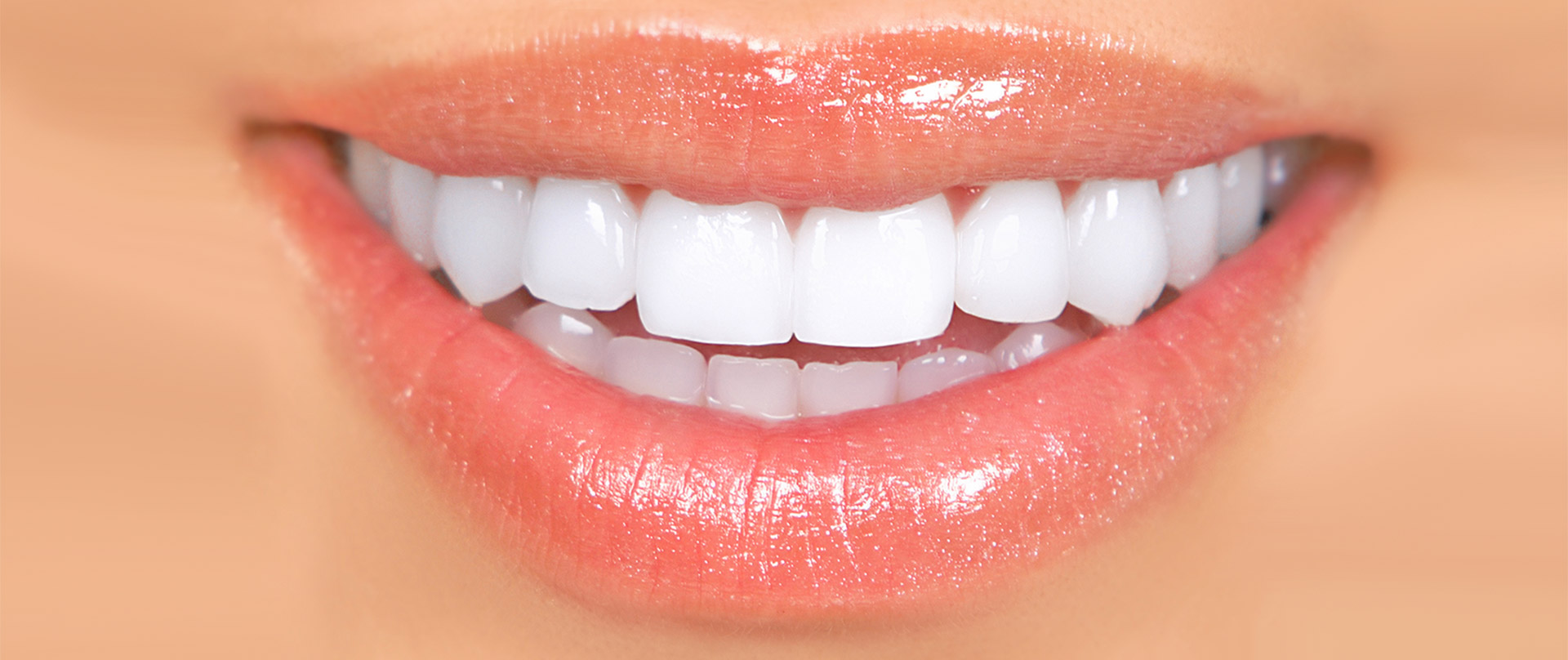 Veeners, hauchdünne Keramikschalen für Ihre Frontzähne