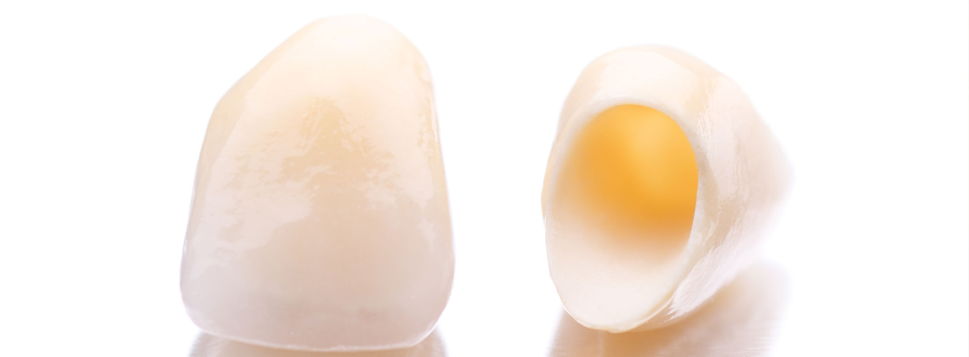 Vollkeramische Kronen, Brücken, Inlays · Moderne Hochleistungskeramik aus Zirkonoxid bietet zahlreiche Vorteile. Zahnärzte Dr. Gorden & Poll Dortmund