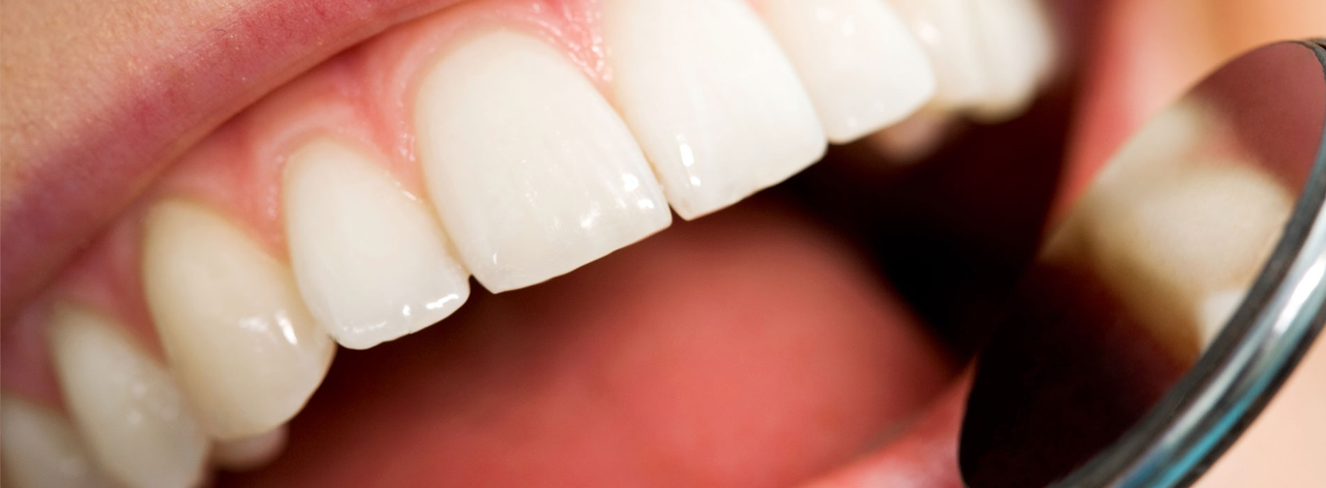 Professionelle Zahnreinigung - lebenslanger Erhalt der Zähne dank moderner PZR